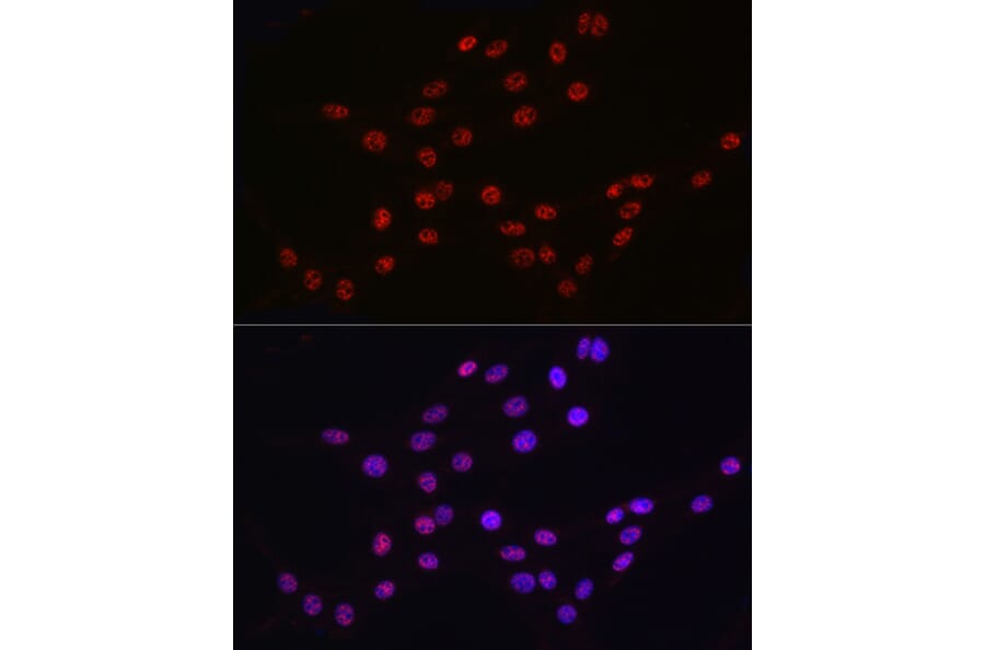Immunofluorescence - Anti-DDX39 Antibody (A16003) - Antibodies.com