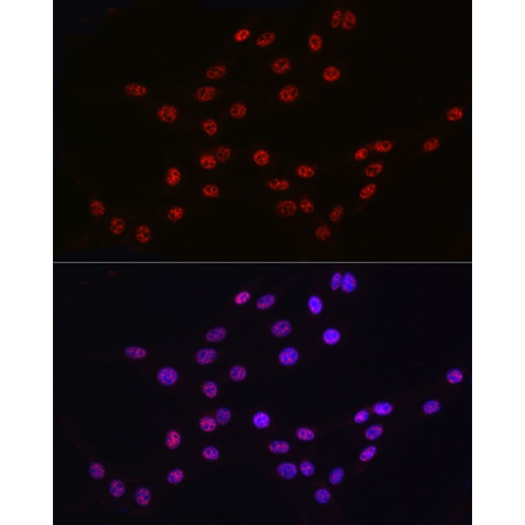 Immunofluorescence - Anti-DDX39 Antibody (A16003) - Antibodies.com