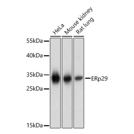 Western Blot - Anti-ERP29 Antibody (A16004) - Antibodies.com