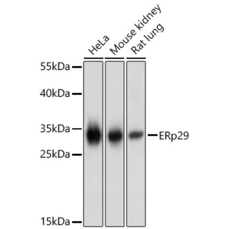 Western Blot - Anti-ERP29 Antibody (A16004) - Antibodies.com