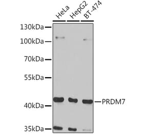 Western Blot - Anti-PRDM7 Antibody (A16005) - Antibodies.com