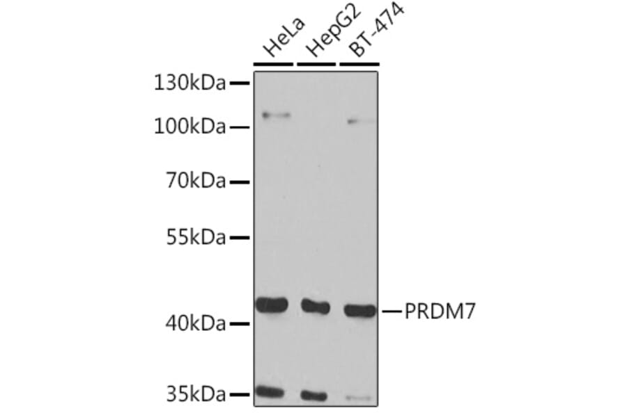 Western Blot - Anti-PRDM7 Antibody (A16005) - Antibodies.com