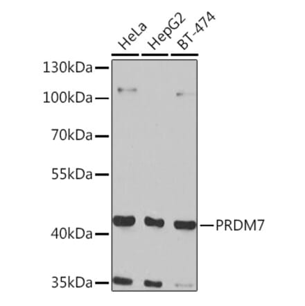 Western Blot - Anti-PRDM7 Antibody (A16005) - Antibodies.com