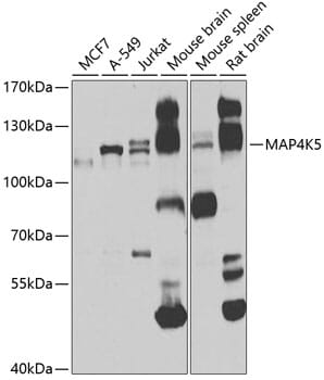 Western blot analysis of extracts of various cell lines, using Anti-MAP4K5 Antibody (A7962) at 1:1,000 dilution.
Secondary antibody: Goat Anti-Rabbit IgG (H+L) (HRP) (AS014) at 1:10,000 dilution.
Lysates / proteins: 25µg per lane.
Blocking buffer: 3% non-fat dry milk in TBST.
Detection: ECL Basic Kit (RM00020).
Exposure time: 20s.