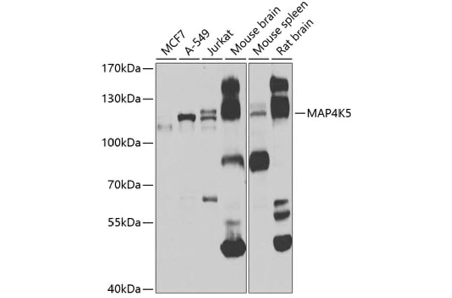 Western Blot - Anti-MAP4K5 Antibody (A16006) - Antibodies.com