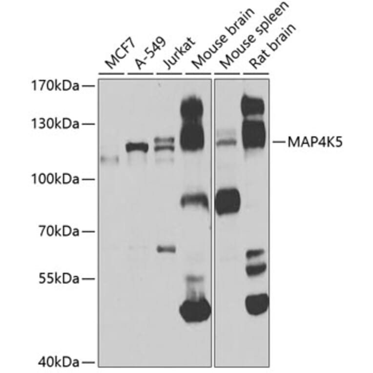 Western Blot - Anti-MAP4K5 Antibody (A16006) - Antibodies.com