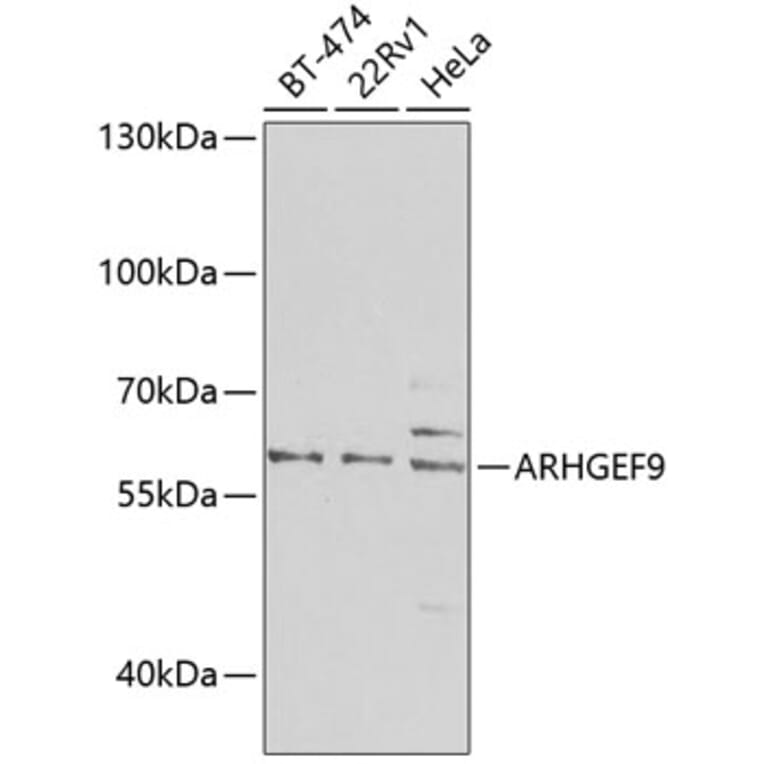 Western Blot - Anti-ARHGEF9 Antibody (A16007) - Antibodies.com