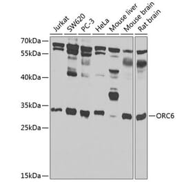 Western Blot - Anti-ORC6 Antibody (A16009) - Antibodies.com