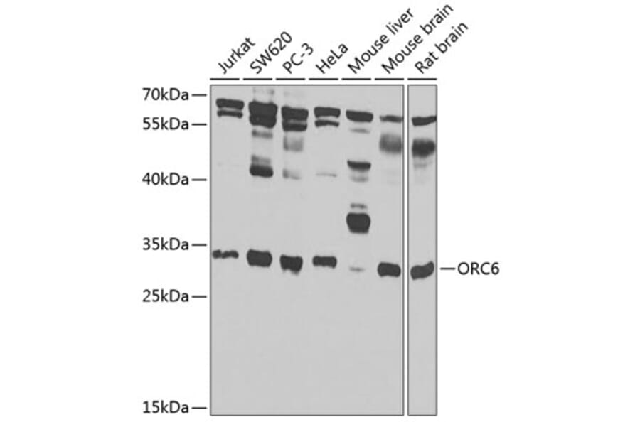 Western Blot - Anti-ORC6 Antibody (A7966) - Antibodies.com