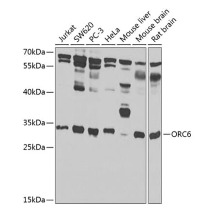 Western Blot - Anti-ORC6 Antibody (A7966) - Antibodies.com