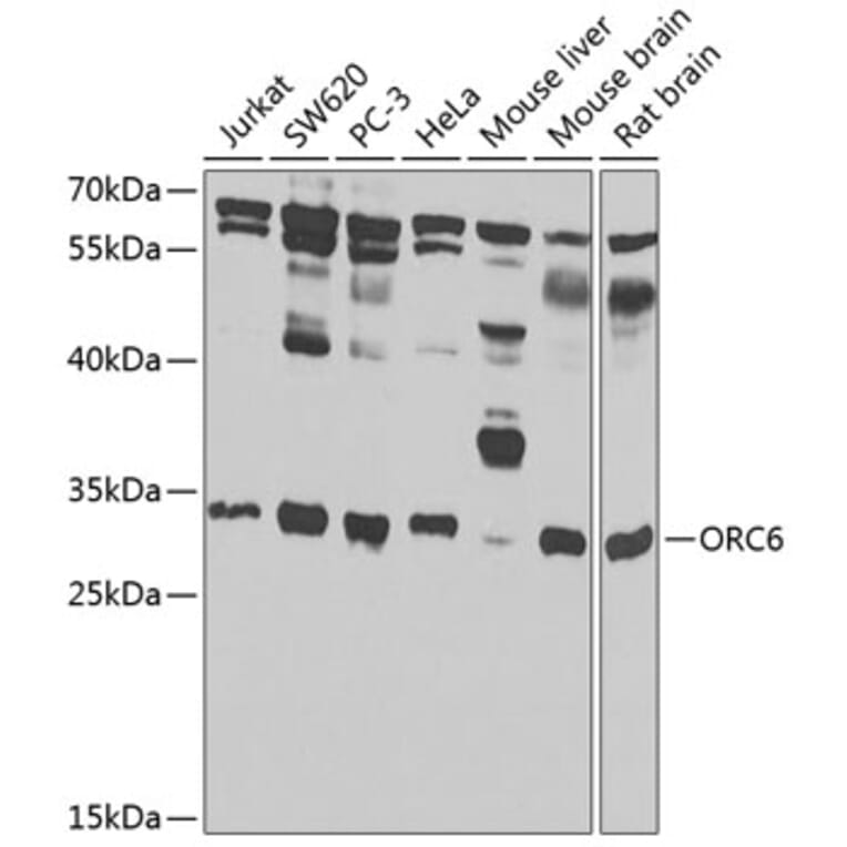 Western Blot - Anti-ORC6 Antibody (A7966) - Antibodies.com