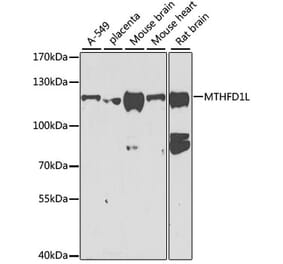Western Blot - Anti-MTHFD1L Antibody (A16010) - Antibodies.com