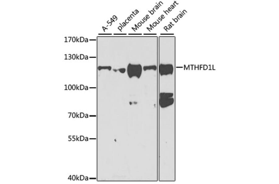 Western Blot - Anti-MTHFD1L Antibody (A16010) - Antibodies.com