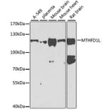 Western Blot - Anti-MTHFD1L Antibody (A16010) - Antibodies.com