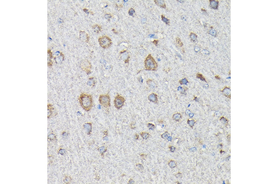 Immunohistochemistry - Anti-MTHFD1L Antibody (A16010) - Antibodies.com