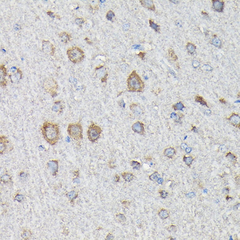 Immunohistochemistry - Anti-MTHFD1L Antibody (A16010) - Antibodies.com
