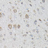 Immunohistochemistry - Anti-MTHFD1L Antibody (A16010) - Antibodies.com