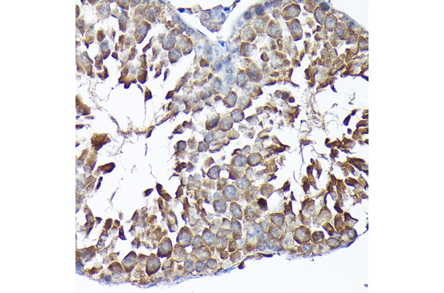 Immunohistochemistry - Anti-MTHFD1L Antibody (A16010) - Antibodies.com