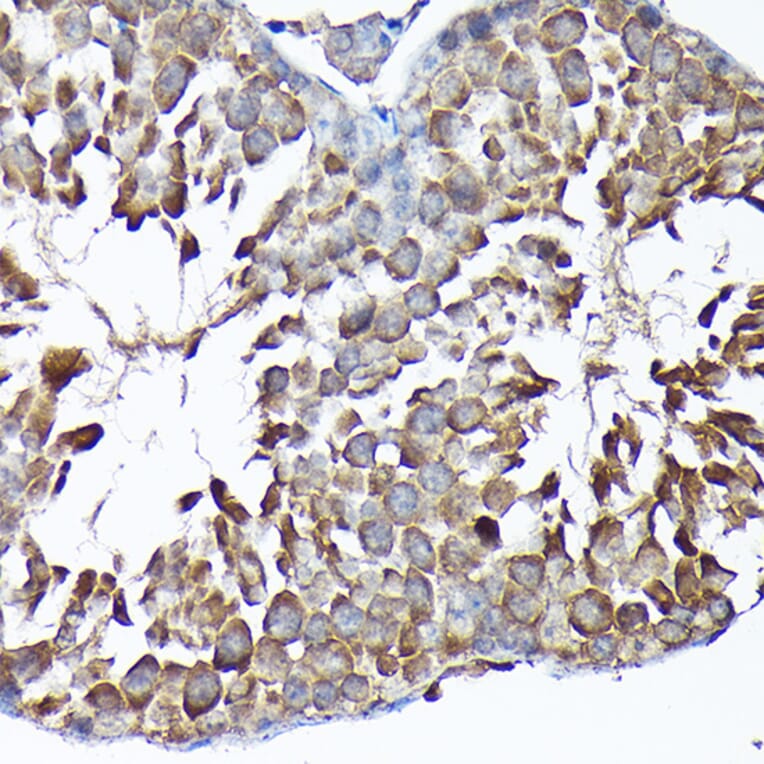 Immunohistochemistry - Anti-MTHFD1L Antibody (A16010) - Antibodies.com