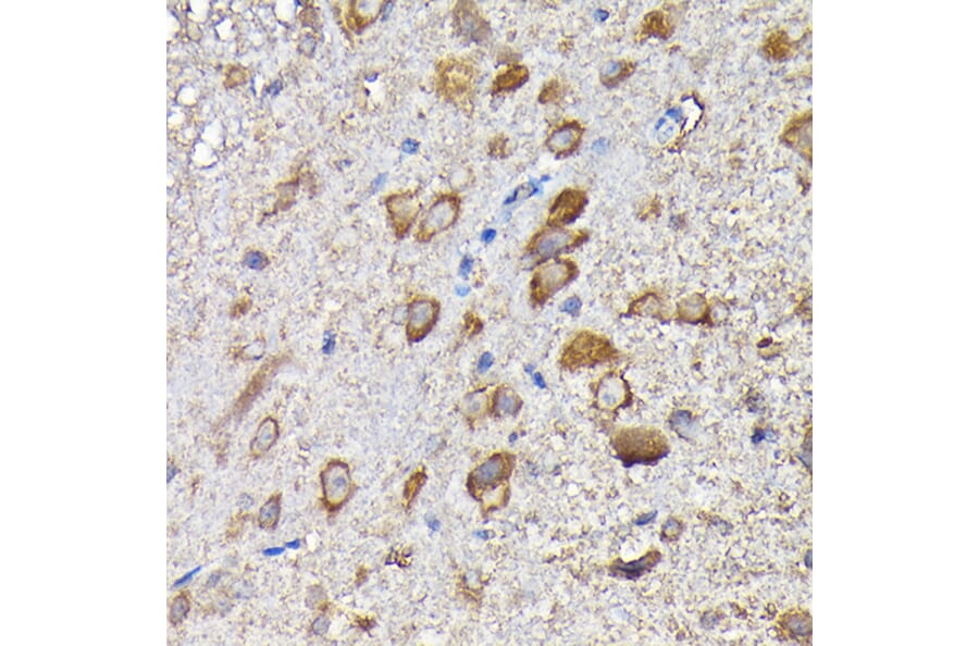 Immunohistochemistry - Anti-MTHFD1L Antibody (A16010) - Antibodies.com