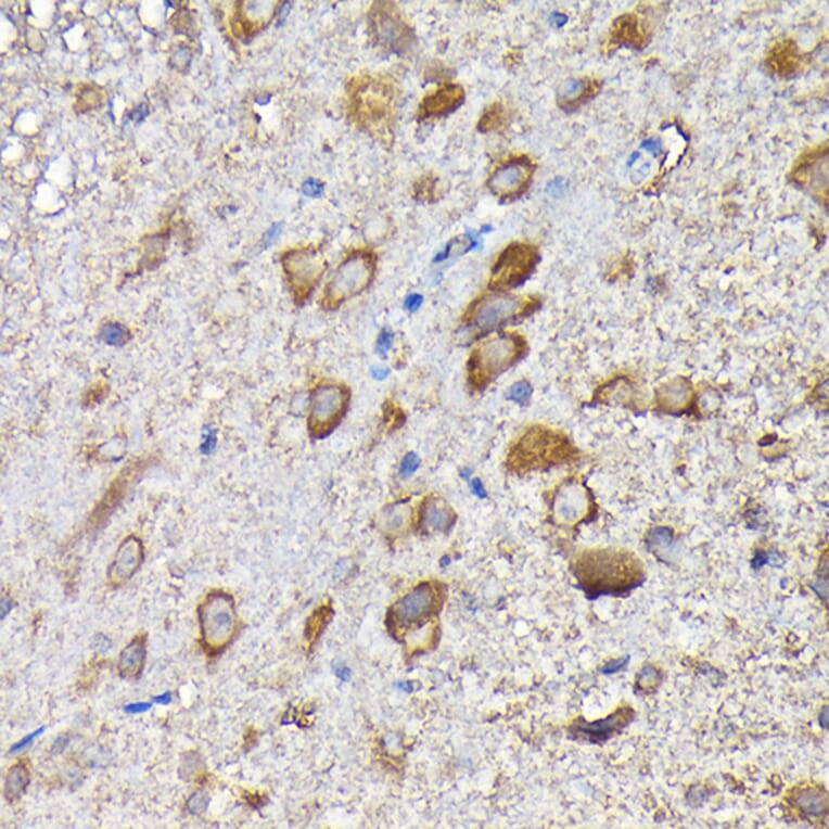 Immunohistochemistry - Anti-MTHFD1L Antibody (A16010) - Antibodies.com