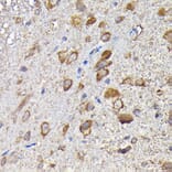Immunohistochemistry - Anti-MTHFD1L Antibody (A16010) - Antibodies.com