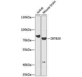 Western Blot - Anti-ZBTB20 Antibody (A16011) - Antibodies.com