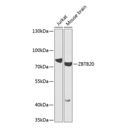 Western Blot - Anti-ZBTB20 Antibody (A16011) - Antibodies.com