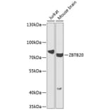 Western Blot - Anti-ZBTB20 Antibody (A16011) - Antibodies.com