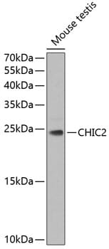 Western blot analysis of extracts of mouse testis, using Anti-CHIC2 Antibody (A7971) at 1:1,000 dilution.
Secondary antibody: Goat Anti-Rabbit IgG (H+L) (HRP) (AS014) at 1:10,000 dilution.
Lysates / proteins: 25µg per lane.
Blocking buffer: 3% non-fat dry milk in TBST.
Detection: ECL Enhanced Kit (RM00021).
Exposure time: 90s.