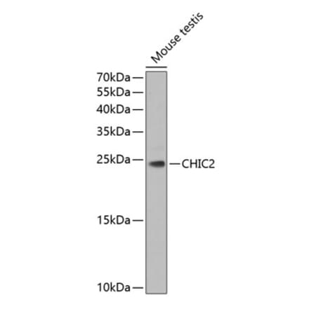 Western Blot - Anti-CHIC2 Antibody (A16012) - Antibodies.com