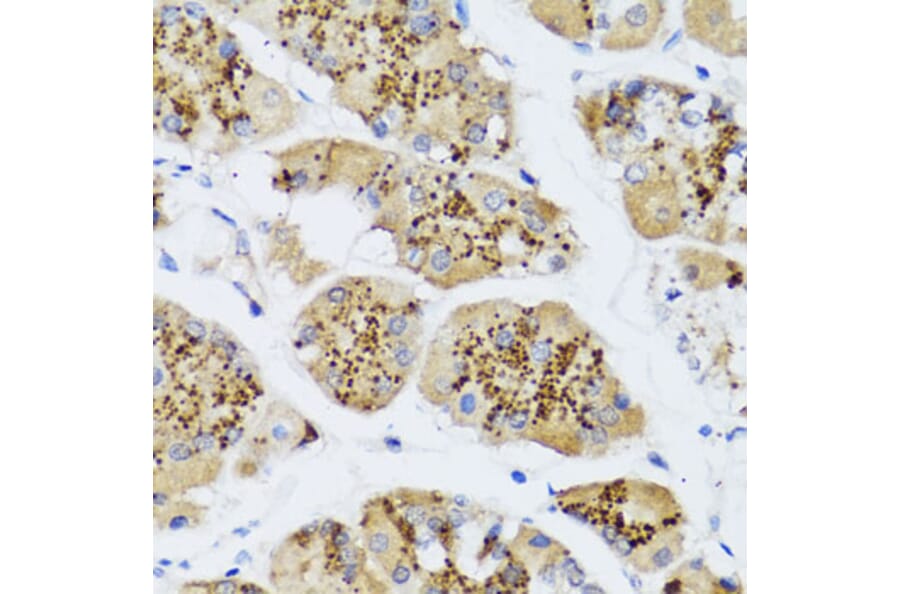 Immunohistochemistry - Anti-CHIC2 Antibody (A16012) - Antibodies.com