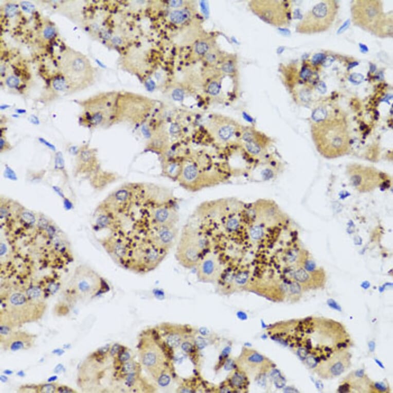 Immunohistochemistry - Anti-CHIC2 Antibody (A16012) - Antibodies.com