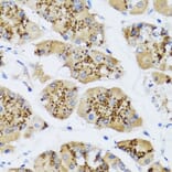 Immunohistochemistry - Anti-CHIC2 Antibody (A16012) - Antibodies.com