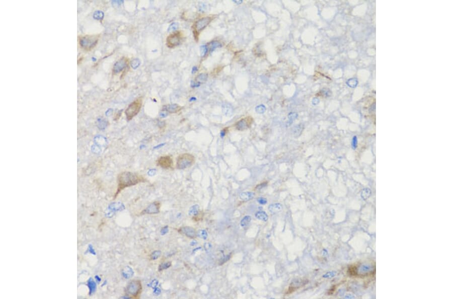 Immunohistochemistry - Anti-CHIC2 Antibody (A16012) - Antibodies.com