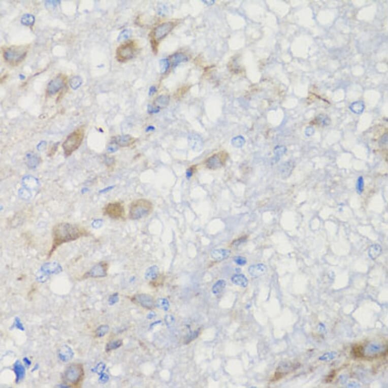 Immunohistochemistry - Anti-CHIC2 Antibody (A16012) - Antibodies.com