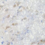 Immunohistochemistry - Anti-CHIC2 Antibody (A16012) - Antibodies.com