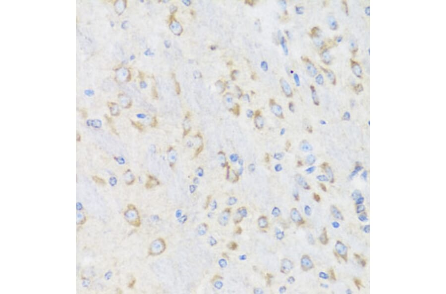 Immunohistochemistry - Anti-CHIC2 Antibody (A16012) - Antibodies.com
