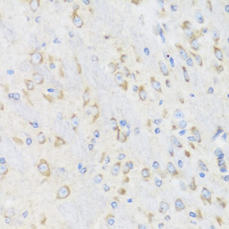Immunohistochemistry - Anti-CHIC2 Antibody (A16012) - Antibodies.com
