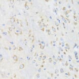 Immunohistochemistry - Anti-CHIC2 Antibody (A16012) - Antibodies.com