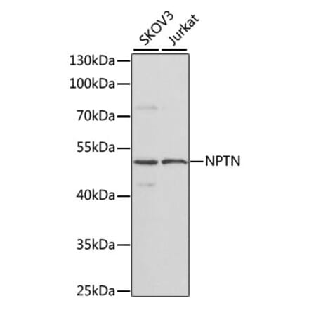 Western Blot - Anti-NPTN Antibody (A16013) - Antibodies.com