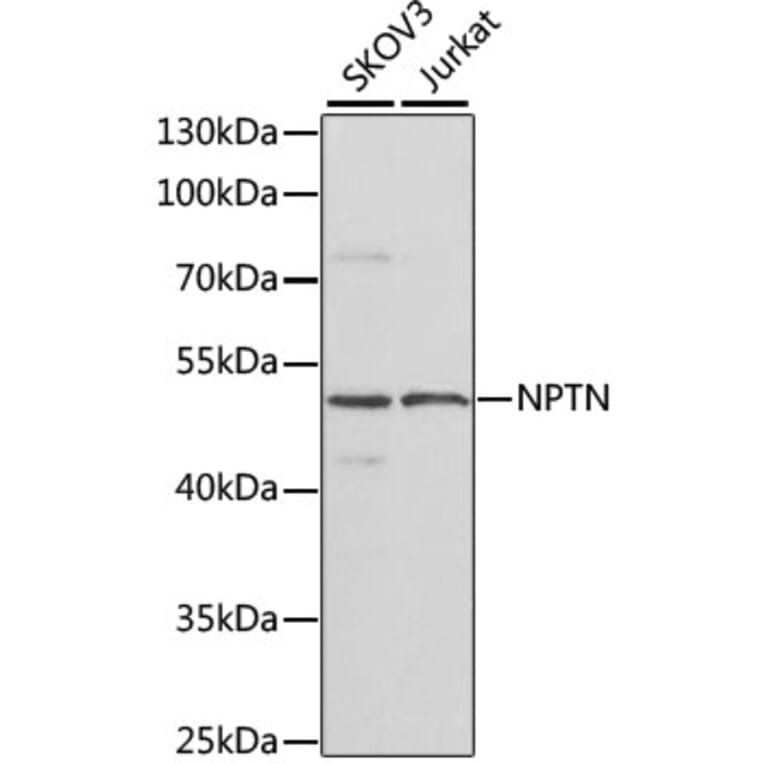 Western Blot - Anti-NPTN Antibody (A16013) - Antibodies.com