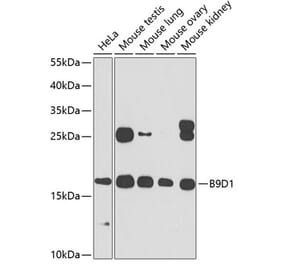 Western Blot - Anti-B9D1 Antibody (A16014) - Antibodies.com