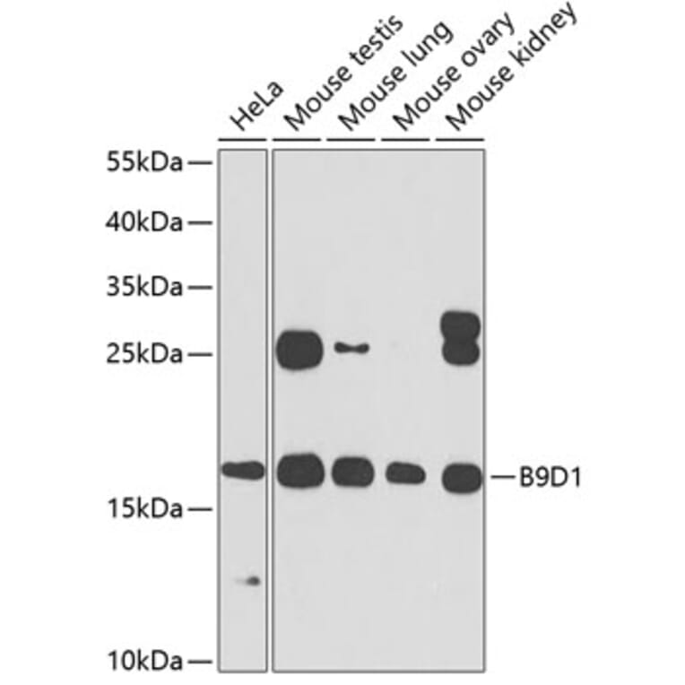 Western Blot - Anti-B9D1 Antibody (A16014) - Antibodies.com