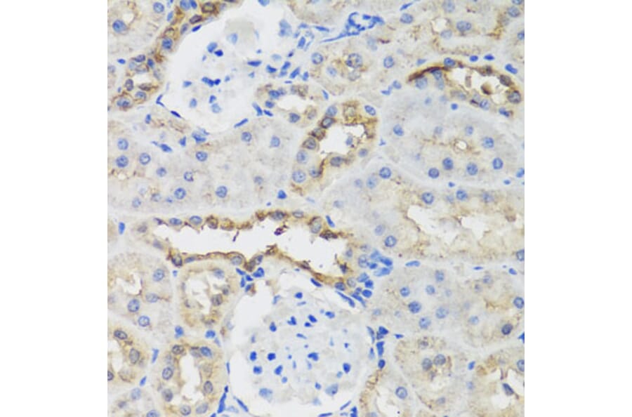 Immunohistochemistry - Anti-B9D1 Antibody (A16014) - Antibodies.com