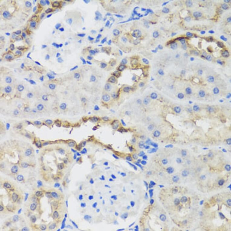 Immunohistochemistry - Anti-B9D1 Antibody (A16014) - Antibodies.com