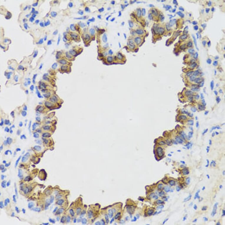 Immunohistochemistry - Anti-B9D1 Antibody (A16014) - Antibodies.com