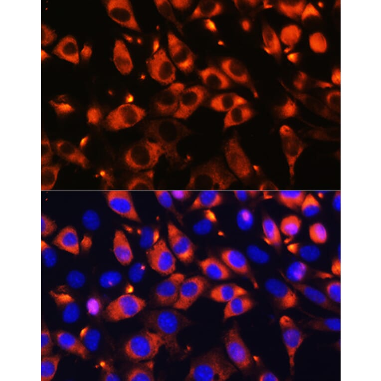 Immunofluorescence - Anti-B9D1 Antibody (A16014) - Antibodies.com