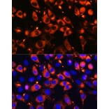 Immunofluorescence - Anti-B9D1 Antibody (A16014) - Antibodies.com
