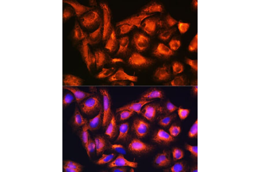 Immunofluorescence - Anti-B9D1 Antibody (A16014) - Antibodies.com